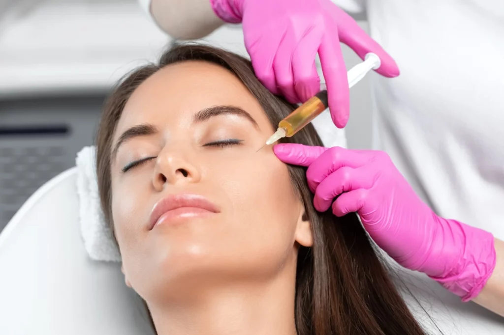 PRP Facial Injections