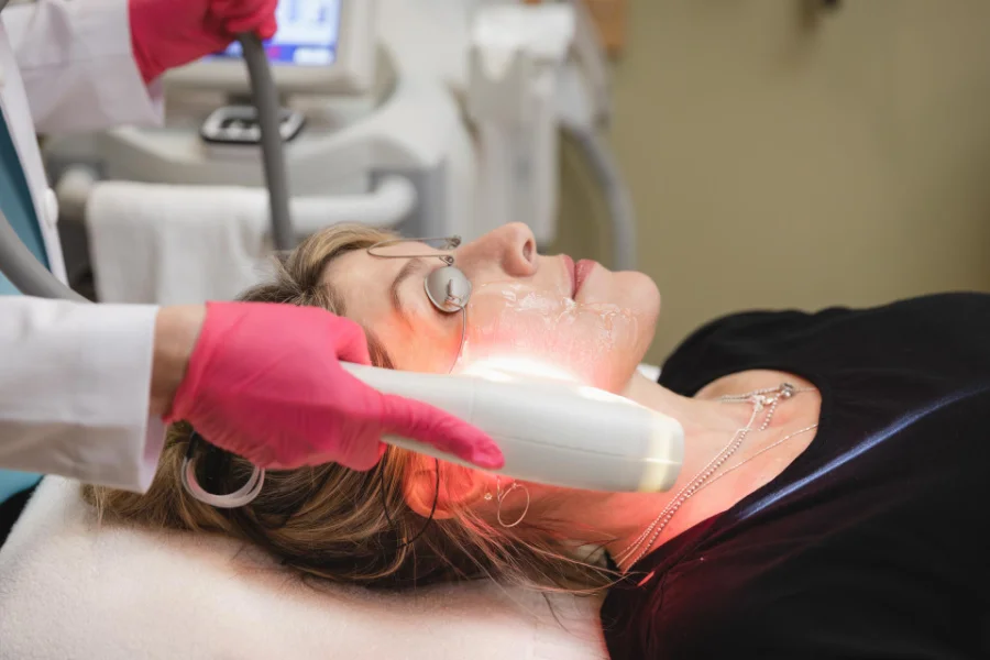 SkinTyte® Laser Treatments in Stuart