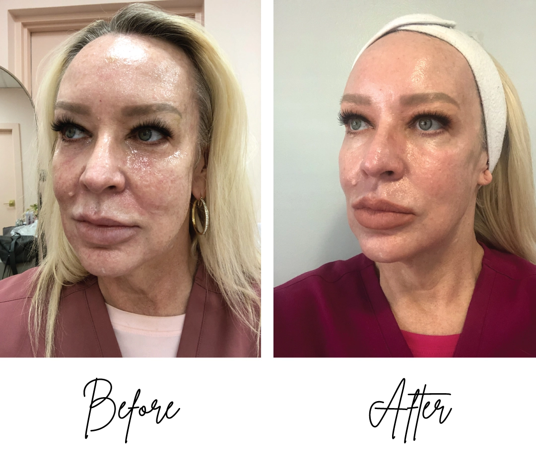 Before-after-CO2-treatment